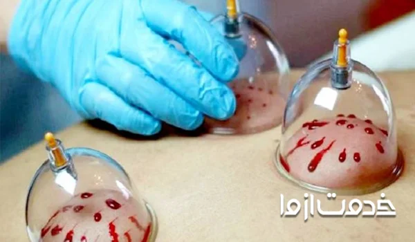 نرخ حجامت
